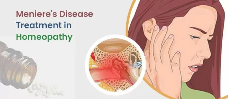 Homeopathy Treatment For Menieres Disease