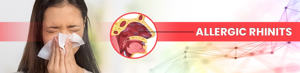Homeopathy Treatment For Rhinitis