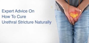 Homeopathy Treatment For Urethral Stricture