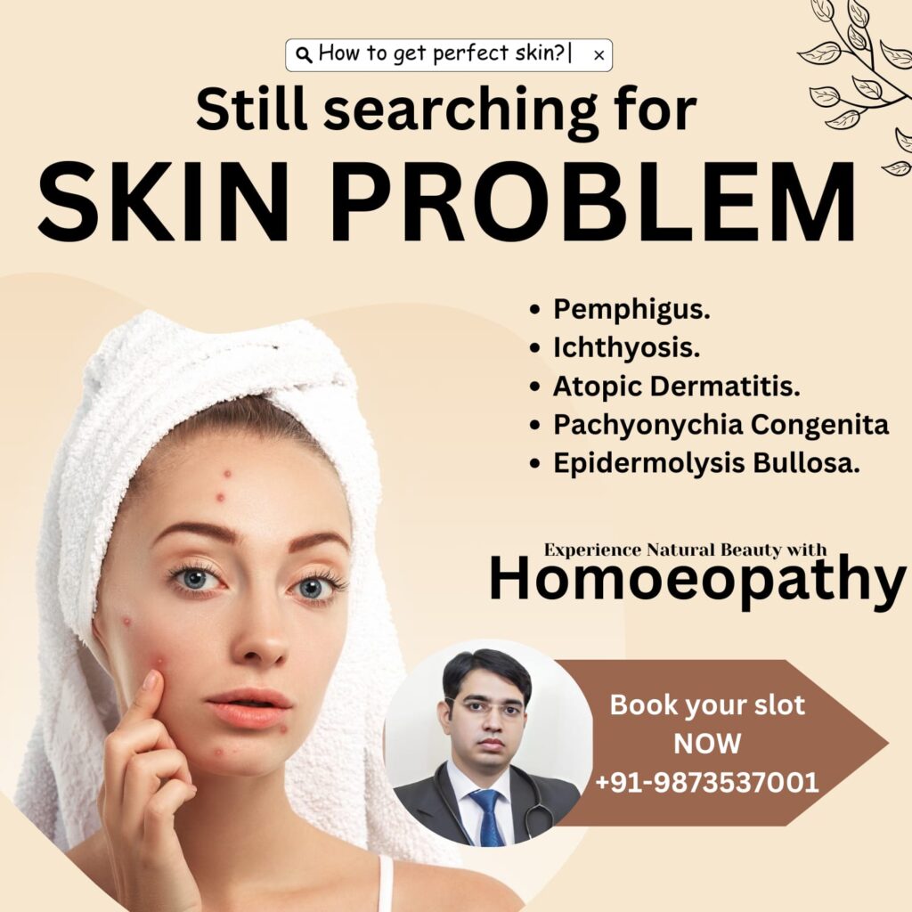 Best Homeopathy Doctor in Faridabad Skin