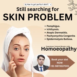 Best Homeopathy Doctor in Gurgaon Skin