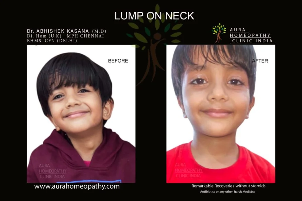 Aura Homeopathy clinic in delhi