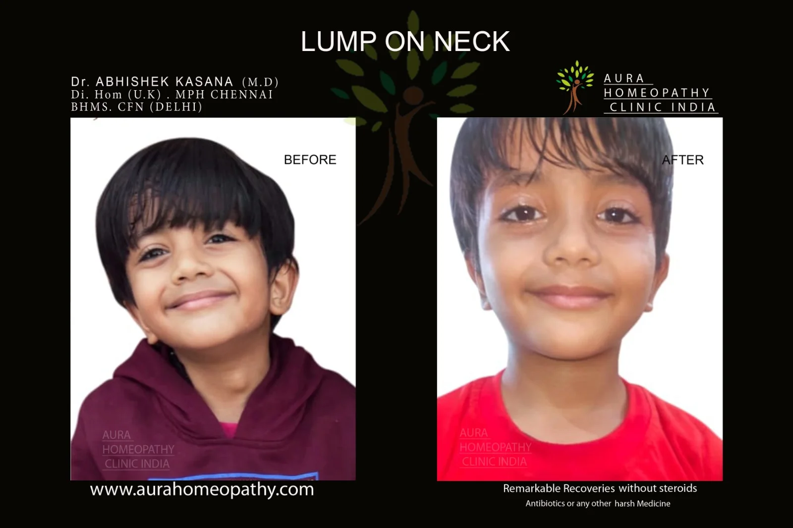 Aura Homeopathy clinic in delhi