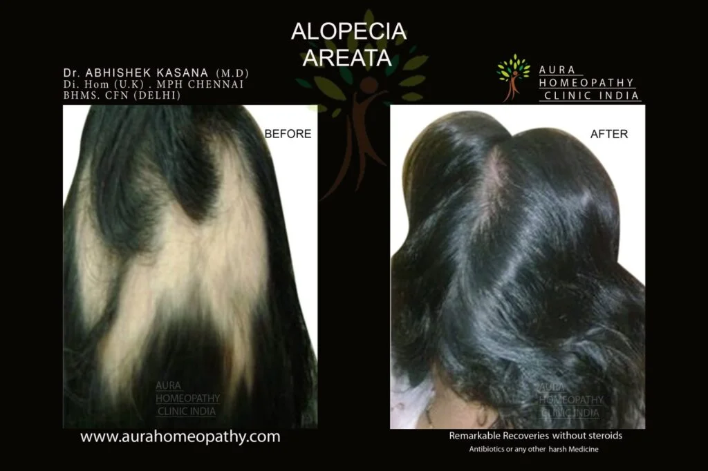 Aura Homeopathy result