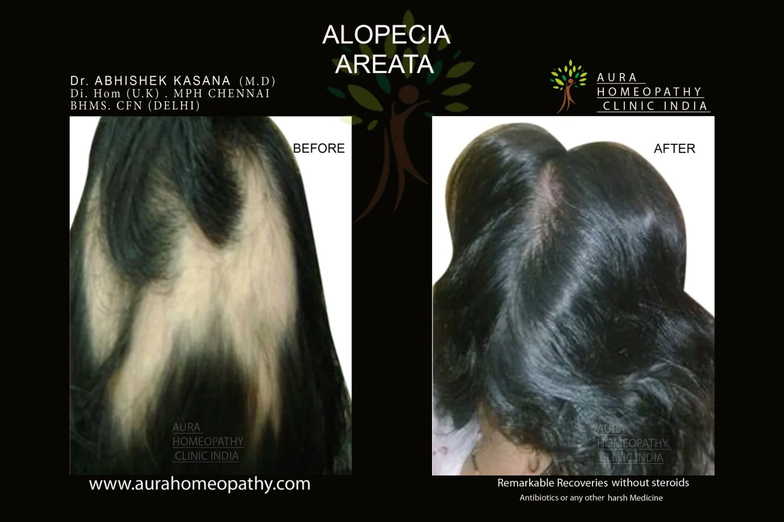 Aura Homeopathy result