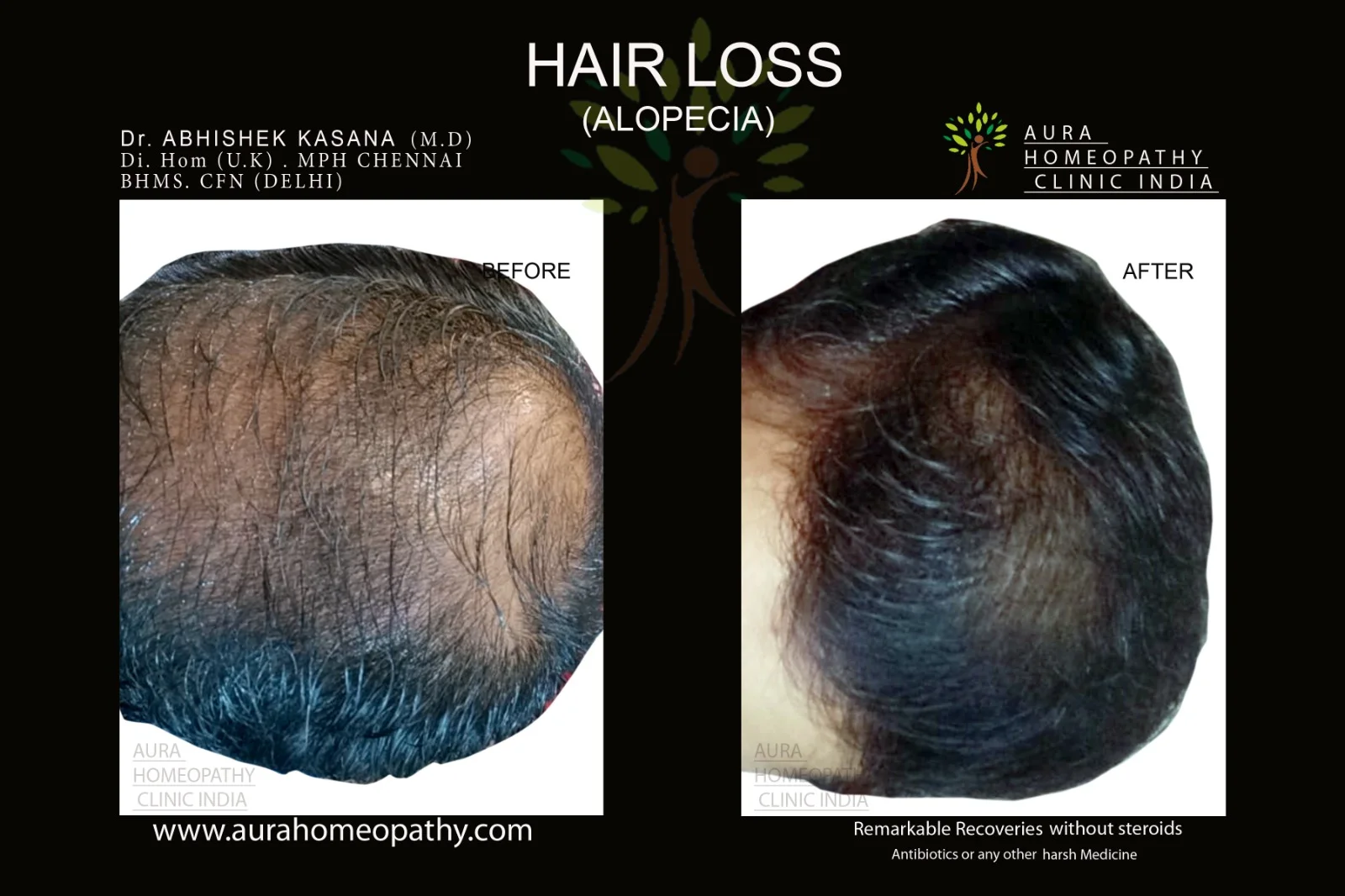 Homeopathy clinic for Hair Loss