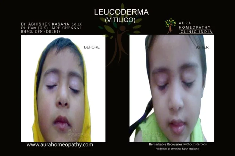 Aura Homeopathy clinic