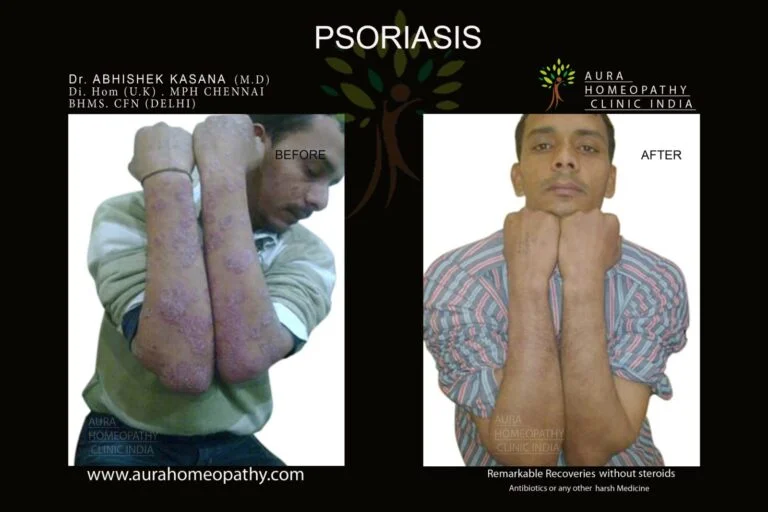 Homeopathy clinic for skin allergy