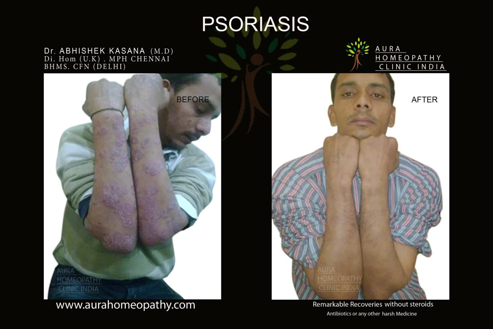 Homeopathy clinic for skin allergy