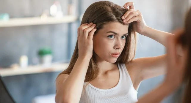 Homeopathy for Seborrheic Dermatitis Delhi