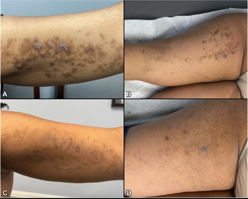 Photo from customer review