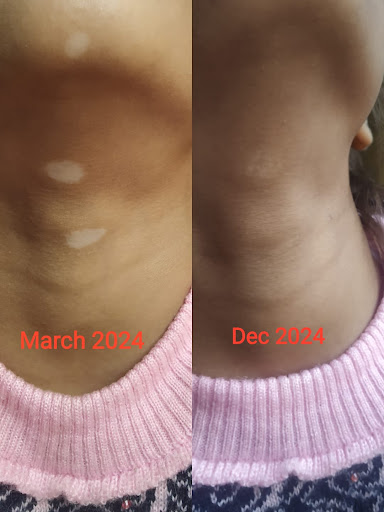 Photo from customer review