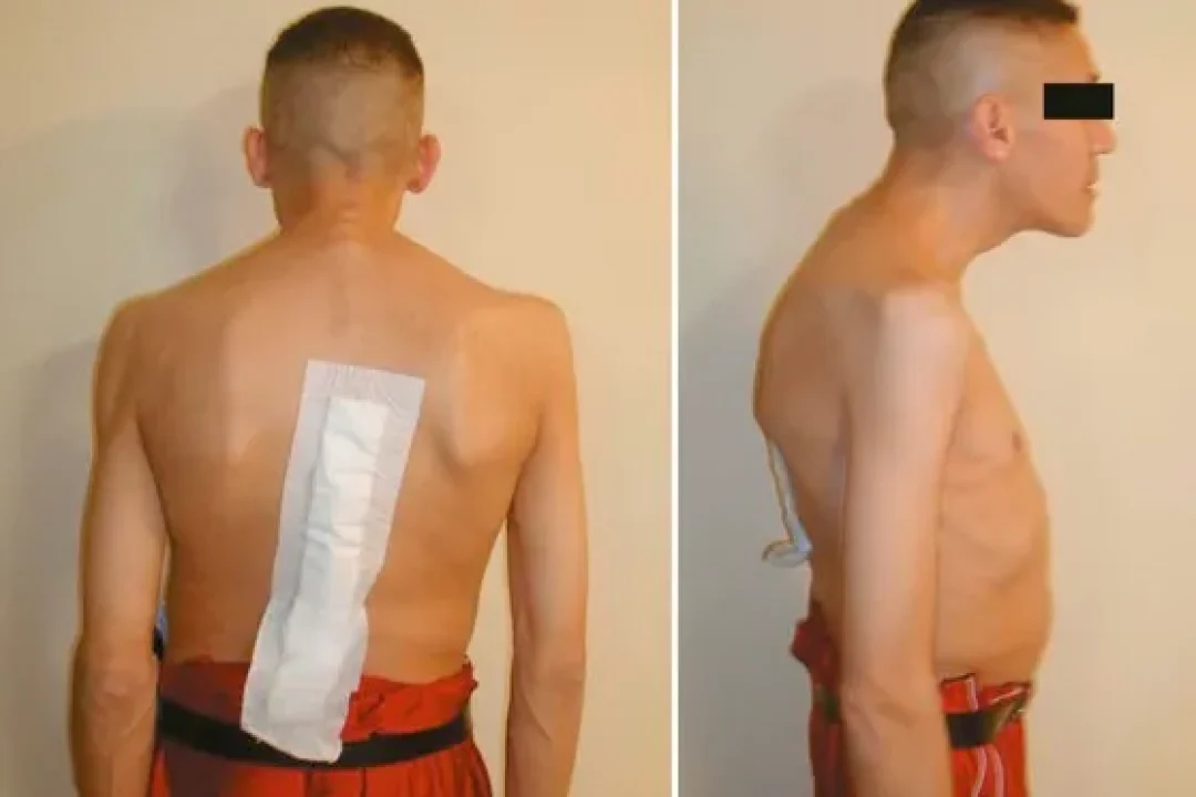 B9781416067269000353_f035-004ab-9781416067269